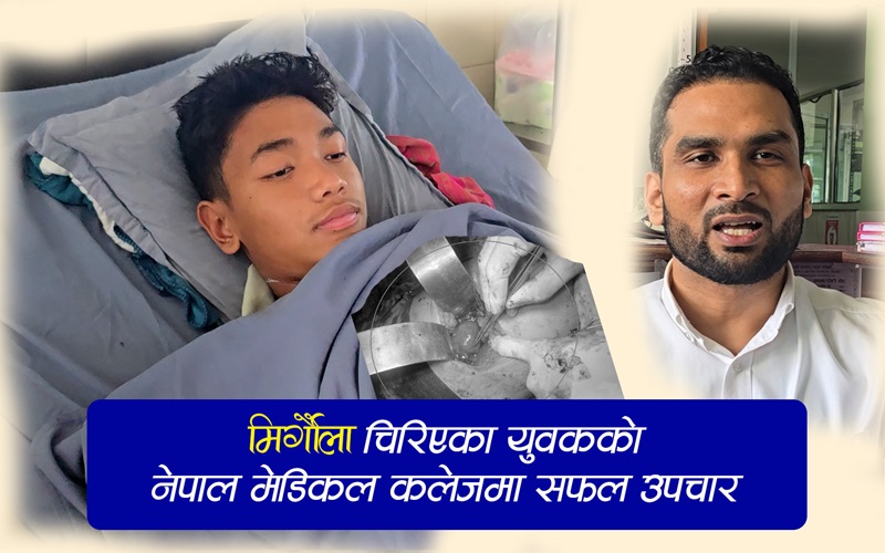 मिर्गौला चिरिएका युवकको नेपाल मेडिकल कलजले बचायो ज्यान (भिडियो सहित)